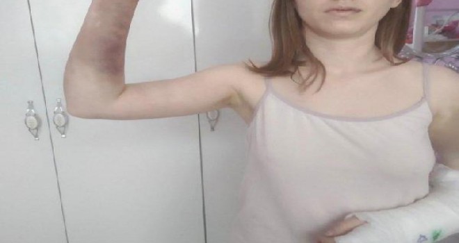 Karşıyaka'da kız arkadaşını beyzbol sopasıyla darp ettiği iddiasıyla tutuklandı