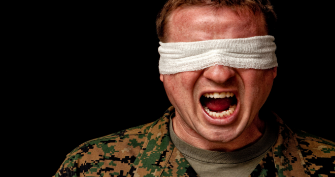 Bireyin Kendi İçerisinde Yaşadıkları Olumsuzlukları Dışarıya Yansıtmasına Neden Ruhsal Problem Histeri