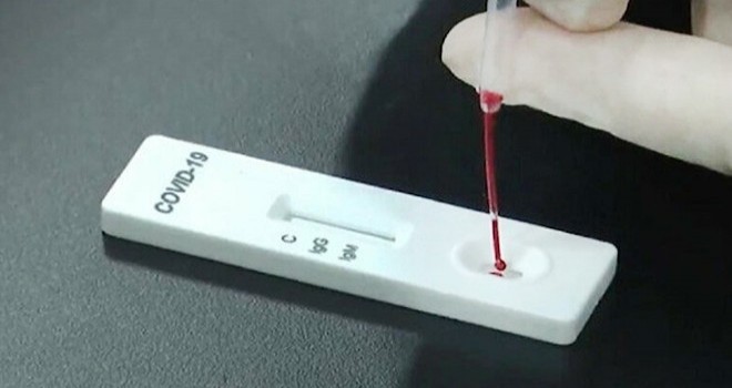 İzmir'de koronavirüsten vefat eden kişi sayısı açıklandı