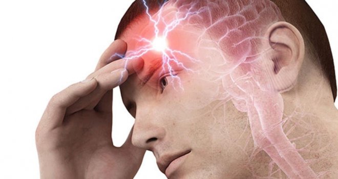 Beyin kanamasına ameliyatsız tedavi