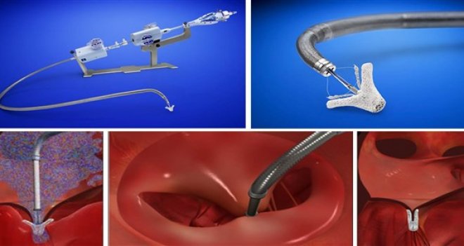 Bu mandallar hayat kurtarıyor