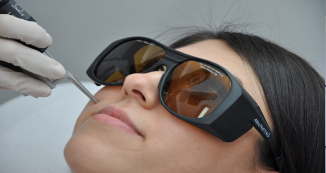 Estetikte lazer devrimi