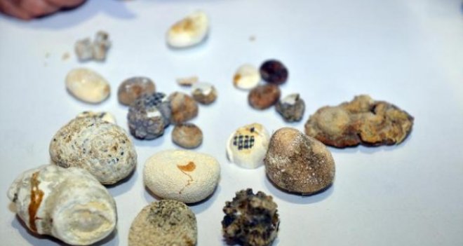 Fuarda böbrek taşı sergisi