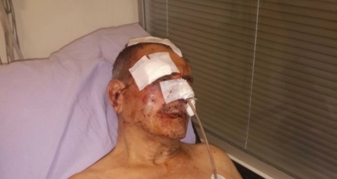 Karşıyaka'da apartman aidatını isteyen yönetici hastanelik oldu