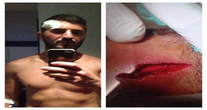 Karşıyakalı Rıdvan'a 15 dikiş atıldı