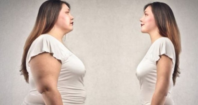 Mide küçültme ameliyatı kimlere yapılmalı?