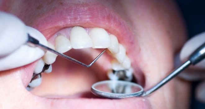 Sağlıksız dişlere dikkat...