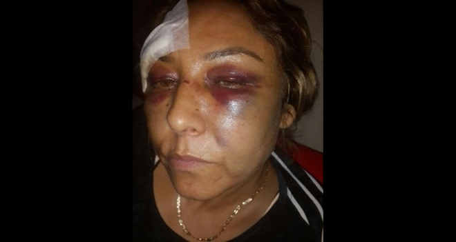 Saldırganın serbest bırakılmasına tepki...